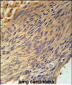 CPEB4 Antibody (N-term)